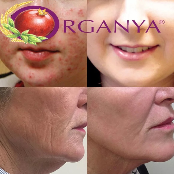 Retinol 18 Vitamin A Revolution Night Serum 30ml - Picture 4 of 14